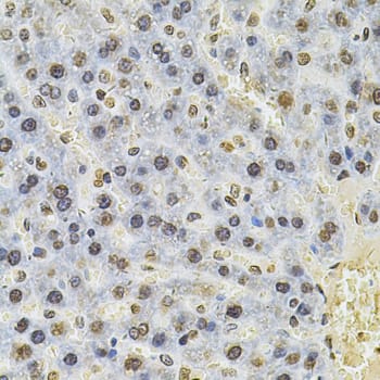 Immunohistochemistry: PSMC3 Antibody [NBP3-35909] - Immunohistochemistry analysis of paraffin-embedded Rat liver using PSMC3 Rabbit pAb at dilution of 1:100 (40x lens). Microwave antigen retrieval performed with 0.01M PBS Buffer (pH 7.2) prior to IHC staining.