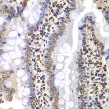 Immunohistochemistry: PSMC3 Antibody [NBP3-35909] - Immunohistochemistry analysis of paraffin-embedded Rat intestine using PSMC3 Rabbit pAb at dilution of 1:200 (40x lens). Microwave antigen retrieval performed with 0.01M PBS Buffer (pH 7.2) prior to IHC staining.