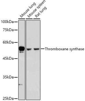 Western Blot: Thromboxane synthase Antibody [NBP3-35910] - Western blot analysis of various lysates using Thromboxane synthase Rabbit pAb at 1:500 dilution.Secondary antibody: HRP-conjugated Goat anti-Rabbit IgG (H+L) at 1:10000 dilution.Lysates/proteins: 25ug per lane.Blocking buffer: 3% nonfat dry milk in TBST.Detection: ECL Basic Kit.Exposure time: 5s.