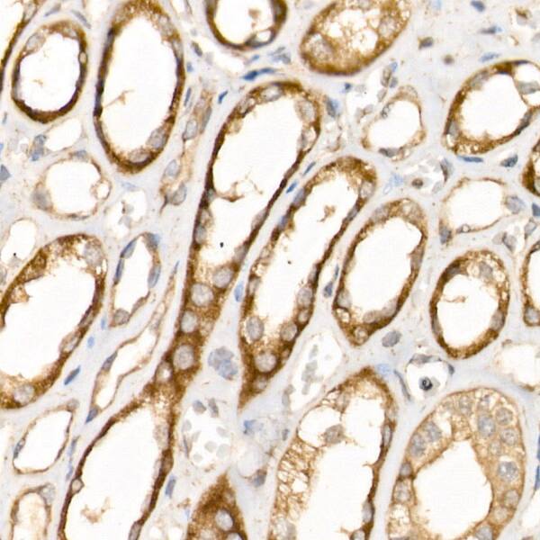 Immunohistochemistry: Beta 2 Adaptin Antibody [NBP3-35911] - Immunohistochemistry analysis of paraffin-embedded Human kidney using Beta 2 Adaptin Rabbit pAb at dilution of 1:20 (40x lens). High pressure antigen retrieval performed with 0.01M Citrate Bufferr (pH 6.0) prior to IHC staining.