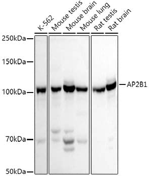 Western Blot Beta 2 Adaptin Antibody