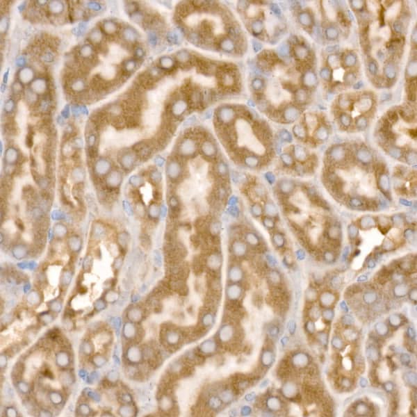 Immunohistochemistry Beta 2 Adaptin Antibody