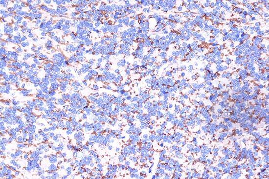 Immunohistochemistry: Myelin PLP Antibody [NBP3-35912] - Immunohistochemistry analysis of paraffin-embedded Rat brain using Myelin PLP Rabbit pAb at dilution of 1:100 (40x lens). Microwave antigen retrieval performed with 0.01M PBS Buffer (pH 7.2) prior to IHC staining.