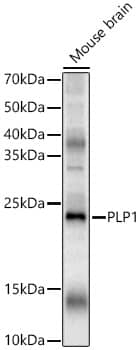 Western Blot: Myelin PLP Antibody [NBP3-35912] - Western blot analysis of various lysates, using Myelin PLP Rabbit pAb at 1:2000 dilution.Secondary antibody: HRP-conjugated Goat anti-Rabbit IgG (H+L) at 1:10000 dilution.Lysates/proteins: 25ug per lane.Blocking buffer: 3% nonfat dry milk in TBST.Detection: ECL Basic Kit.Exposure time: 30s.