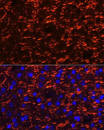 Immunocytochemistry/ Immunofluorescence: Myelin PLP Antibody [NBP3-35912] - Immunofluorescence analysis of paraffin-embedded mouse brain using Myelin PLP Rabbit pAb at dilution of 1:100 (40x lens). Secondary antibody: Cy3-conjugated Goat anti-Rabbit IgG (H+L) at 1:500 dilution. Blue: DAPI for nuclear staining.