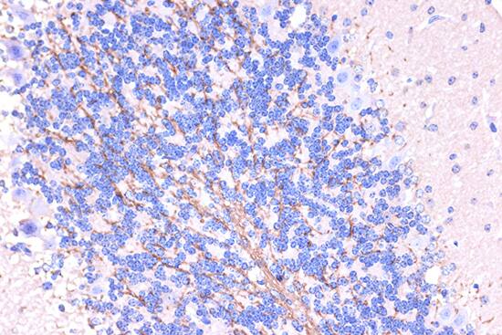 Immunohistochemistry: Myelin PLP Antibody [NBP3-35912] - Immunohistochemistry analysis of paraffin-embedded Mouse brain using Myelin PLP Rabbit pAb at dilution of 1:100 (40x lens). Microwave antigen retrieval performed with 0.01M PBS Buffer (pH 7.2) prior to IHC staining.