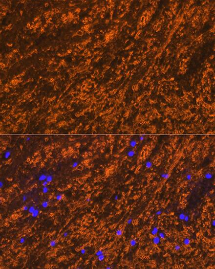 Immunocytochemistry/ Immunofluorescence: Myelin PLP Antibody [NBP3-35912] - Immunofluorescence analysis of paraffin-embedded rat brain using Myelin PLP Rabbit pAb at dilution of 1:100 (40x lens). Secondary antibody: Cy3-conjugated Goat anti-Rabbit IgG (H+L) at 1:500 dilution. Blue: DAPI for nuclear staining.