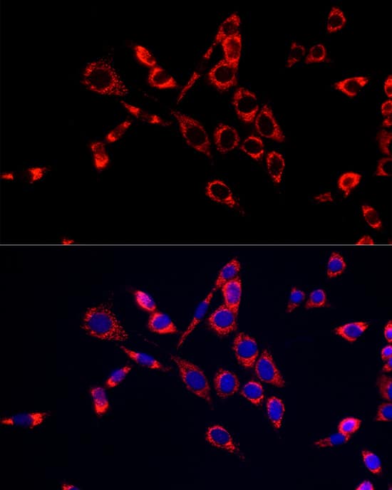 Immunocytochemistry/ Immunofluorescence: Citidine Deaminase Antibody [NBP3-35913] - Immunofluorescence analysis of NIH/3T3 cells using Citidine Deaminase Rabbit pAb at dilution of 1:20 (40x lens). Secondary antibody: Cy3-conjugated Goat anti-Rabbit IgG (H+L) at 1:500 dilution. Blue: DAPI for nuclear staining.