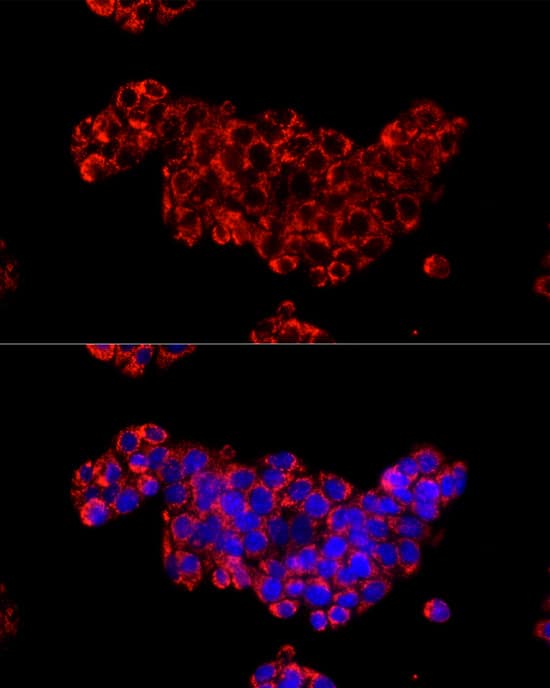 Immunocytochemistry/ Immunofluorescence: Citidine Deaminase Antibody [NBP3-35913] - Immunofluorescence analysis of HepG2 cells using Citidine Deaminase Rabbit pAb at dilution of 1:20 (40x lens). Secondary antibody: Cy3-conjugated Goat anti-Rabbit IgG (H+L) at 1:500 dilution. Blue: DAPI for nuclear staining.