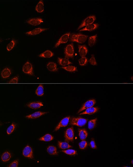 Immunocytochemistry/ Immunofluorescence: Citidine Deaminase Antibody [NBP3-35913] - Immunofluorescence analysis of HeLa cells using Citidine Deaminase Rabbit pAb at dilution of 1:20 (40x lens). Secondary antibody: Cy3-conjugated Goat anti-Rabbit IgG (H+L) at 1:500 dilution. Blue: DAPI for nuclear staining.