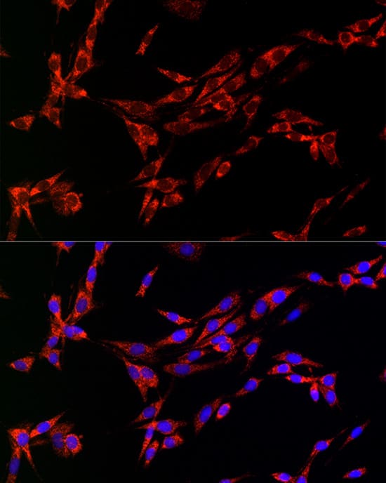 Immunocytochemistry/ Immunofluorescence: Citidine Deaminase Antibody [NBP3-35913] - Immunofluorescence analysis of PC-12 cells using Citidine Deaminase Rabbit pAb at dilution of 1:20 (40x lens). Secondary antibody: Cy3-conjugated Goat anti-Rabbit IgG (H+L) at 1:500 dilution. Blue: DAPI for nuclear staining.