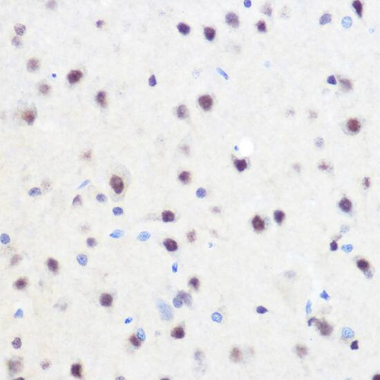Immunohistochemistry ZNF207 Antibody - BSA Free
