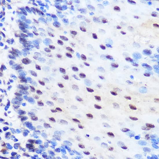 Immunohistochemistry: ZNF207 Antibody [NBP3-35919] - Immunohistochemistry analysis of paraffin-embedded Human esophageal using ZNF207 Rabbit pAb at dilution of 1:100 (40x lens). Microwave antigen retrieval performed with 0.01M Tris/EDTA Buffer (pH 9.0) prior to IHC staining.