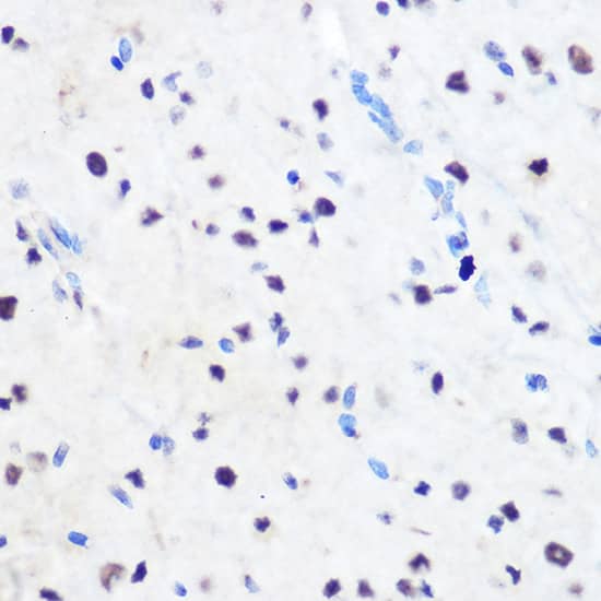 Immunohistochemistry: ZNF207 Antibody [NBP3-35919] - Immunohistochemistry analysis of paraffin-embedded Mouse spinal cord using ZNF207 Rabbit pAb at dilution of 1:100 (40x lens). Microwave antigen retrieval performed with 0.01M Tris/EDTA Buffer (pH 9.0) prior to IHC staining.