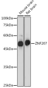 Western Blot: ZNF207 Antibody [NBP3-35919] - Western blot analysis of various lysates using ZNF207 Rabbit pAb at 1:1000 dilution.Secondary antibody: HRP-conjugated Goat anti-Rabbit IgG (H+L) at 1:10000 dilution.Lysates/proteins: 25ug per lane.Blocking buffer: 3% nonfat dry milk in TBST.Detection: ECL Basic Kit.Exposure time: 1s.