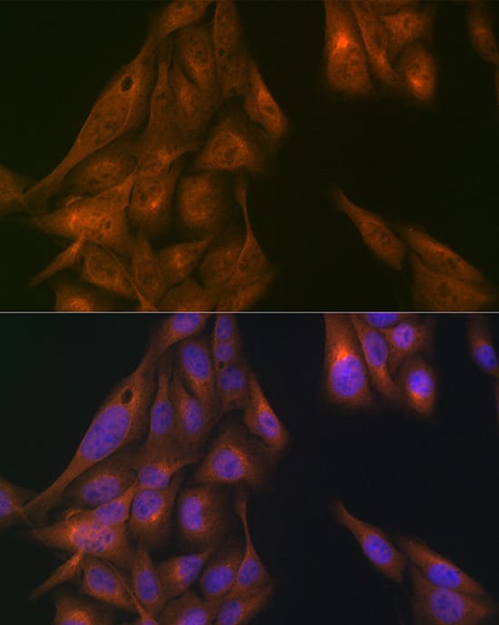 Immunocytochemistry/ Immunofluorescence: USP11 Antibody [NBP3-35921] - Immunofluorescence analysis of U2OS cells using USP11 Rabbit pAb at dilution of 1:100 (40x lens). Secondary antibody: Cy3-conjugated Goat anti-Rabbit IgG (H+L) at 1:500 dilution. Blue: DAPI for nuclear staining.