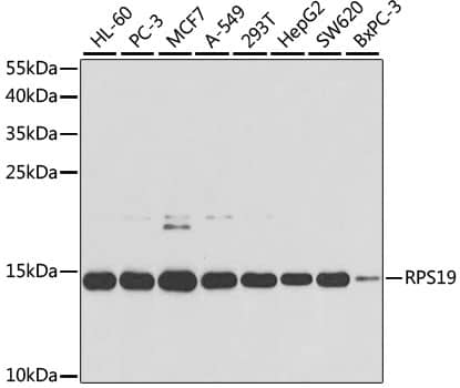 Western Blot: RPS19 Antibody [NBP3-35925] - Western blot analysis of various lysates using RPS19 Rabbit pAb at 1:1000 dilution.Secondary antibody: HRP-conjugated Goat anti-Rabbit IgG (H+L) at 1:10000 dilution.Lysates/proteins: 25ug per lane.Blocking buffer: 3% nonfat dry milk in TBST.Detection: ECL Basic Kit.Exposure time: 90s.