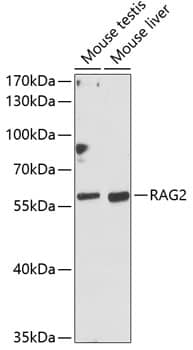 Western Blot: RAG2 Antibody [NBP3-36703] - Western blot analysis of various lysates using RAG2 Rabbit pAb at 1:1000 dilution.Secondary antibody: HRP-conjugated Goat anti-Rabbit IgG (H+L) at 1:10000 dilution.Lysates/proteins: 25ug per lane.Blocking buffer: 3% nonfat dry milk in TBST.Detection: ECL Basic Kit.Exposure time: 90s.