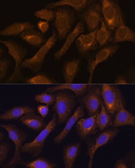 Immunohistochemistry: SHMT1 Antibody [NBP3-36705] - Immunohistochemistry analysis of paraffin-embedded Human stomach using SHMT1 Rabbit pAb at dilution of 1:100 (40x lens). Microwave antigen retrieval performed with 0.01M PBS Buffer (pH 7.2) prior to IHC staining.