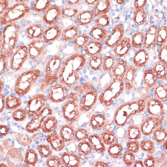 Immunohistochemistry : SHMT1 Antibody [NBP3-36705] -Immunohistochemistry analysis of paraffin-embedded Mouse kidney using SHMT1 Rabbit pAb (A12489) at dilution of 1:100 (40x lens). Microwave antigen retrieval performed with 0.01M PBS Buffer (pH 7.2) prior to IHC staining.