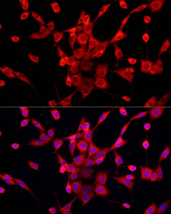 Immunocytochemistry/ Immunofluorescence: PEX5 Antibody [NBP3-36706] - Immunofluorescence analysis of NIH/3T3 cells using PEX5 Rabbit pAb at dilution of 1:100 (40x lens). Secondary antibody: Cy3-conjugated Goat anti-Rabbit IgG (H+L) at 1:500 dilution. Blue: DAPI for nuclear staining.