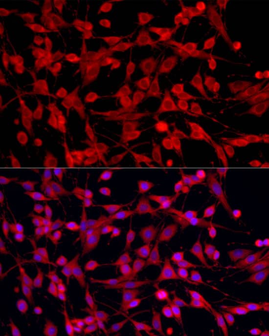 Immunocytochemistry/ Immunofluorescence: PEX5 Antibody [NBP3-36706] - Immunofluorescence analysis of PC-12 cells using PEX5 Rabbit pAb at dilution of 1:100 (40x lens). Secondary antibody: Cy3-conjugated Goat anti-Rabbit IgG (H+L) at 1:500 dilution. Blue: DAPI for nuclear staining.