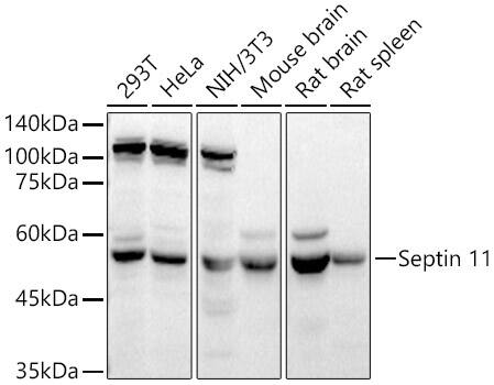 Western Blot: Septin-11 Antibody [NBP3-36708] - Western blot analysis of various lysates using Septin-11 Rabbit pAb at  1:4000 dilution.Secondary antibody: HRP-conjugated Goat anti-Rabbit IgG (H+L) at 1:10000 dilution.Lysates/proteins: 25ug per lane.Blocking buffer: 3% nonfat dry milk in TBST.Detection: ECL Basic Kit.Exposure time: 60s.