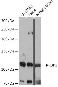 Western Blot: RRBP1 Antibody [NBP3-36709] - Western blot analysis of various lysates using RRBP1 Rabbit pAb at 1:3000 dilution.Secondary antibody: HRP-conjugated Goat anti-Rabbit IgG (H+L) at 1:10000 dilution.Lysates/proteins: 25ug per lane.Blocking buffer: 3% nonfat dry milk in TBST.Detection: ECL Basic Kit.Exposure time: 1s.