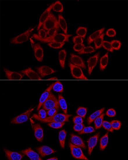 Immunocytochemistry/ Immunofluorescence: RRBP1 Antibody [NBP3-36709] - Confocal immunofluorescence analysis of HeLa cells using RRBP1 Rabbit pAb at dilution of 1:100. Blue: DAPI for nuclear staining.