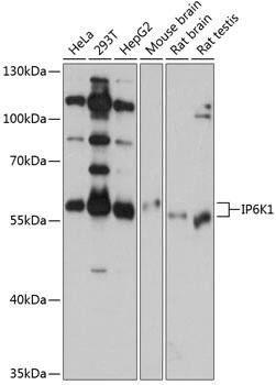 Western Blot IP6K1 Antibody - BSA Free