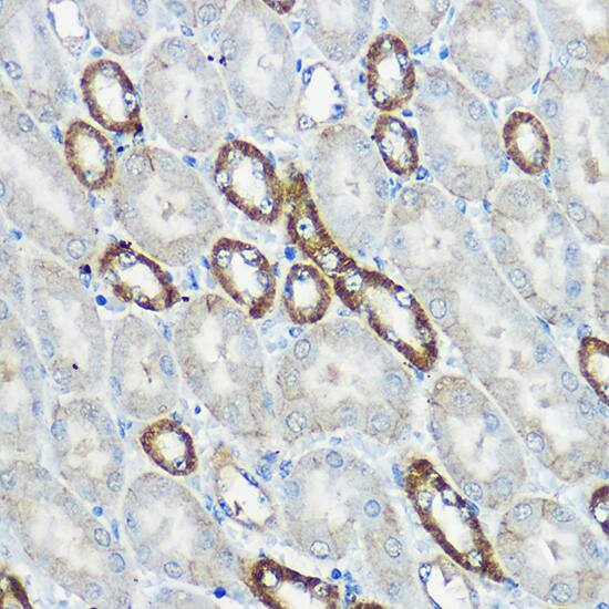 Immunohistochemistry: IP6K1 Antibody [NBP3-36710] - Immunohistochemistry analysis of paraffin-embedded Mouse kidney using IP6K1 Rabbit pAb at dilution of 1:100 (40x lens). High pressure antigen retrieval performed with 0.01M Citrate Bufferr (pH 6.0) prior to IHC staining.