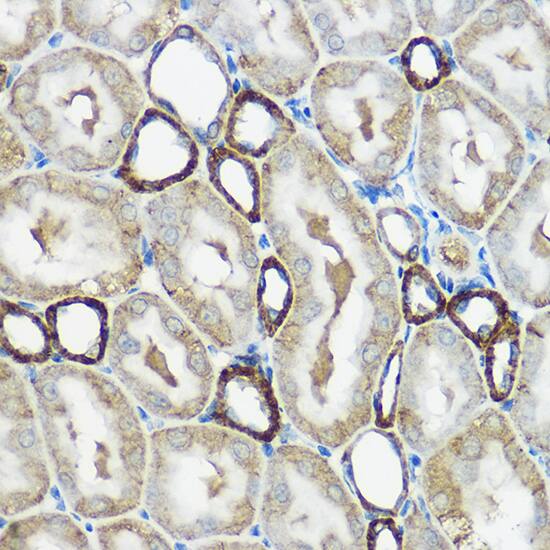 Immunohistochemistry: IP6K1 Antibody [NBP3-36710] - Immunohistochemistry analysis of paraffin-embedded Rat kidney using IP6K1 Rabbit pAb at dilution of 1:100 (40x lens). High pressure antigen retrieval performed with 0.01M Citrate Bufferr (pH 6.0) prior to IHC staining.