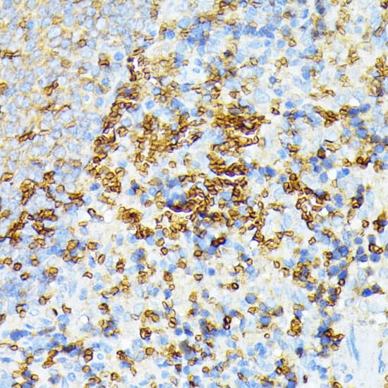 Immunohistochemistry: Spectrin alpha 1 Antibody [NBP3-36712] - Immunohistochemistry analysis of paraffin-embedded Rat spleen using Spectrin alpha 1 Rabbit pAb at dilution of 1:100 (40x lens). Microwave antigen retrieval performed with 0.01M PBS Buffer (pH 7.2) prior to IHC staining.