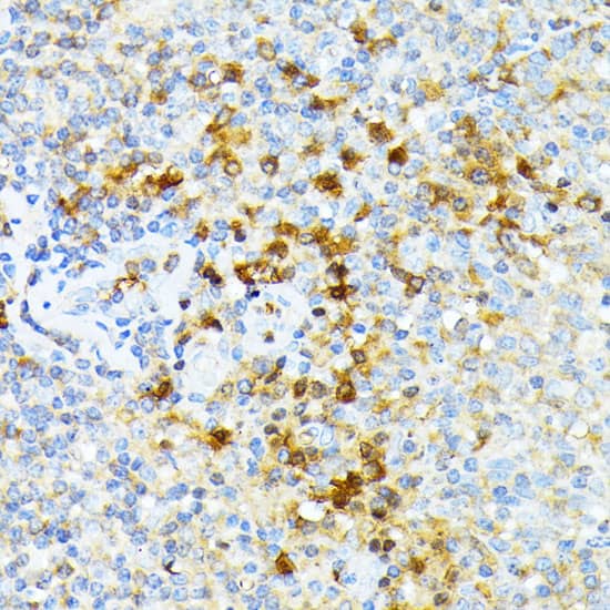 Immunohistochemistry Spectrin alpha 1 Antibody