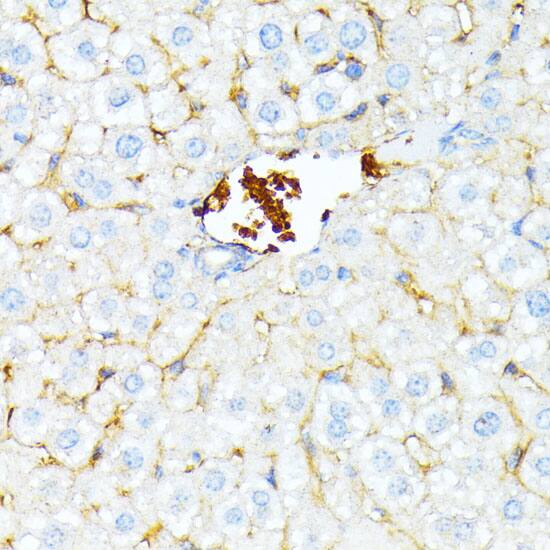 Immunohistochemistry Spectrin alpha 1 Antibody