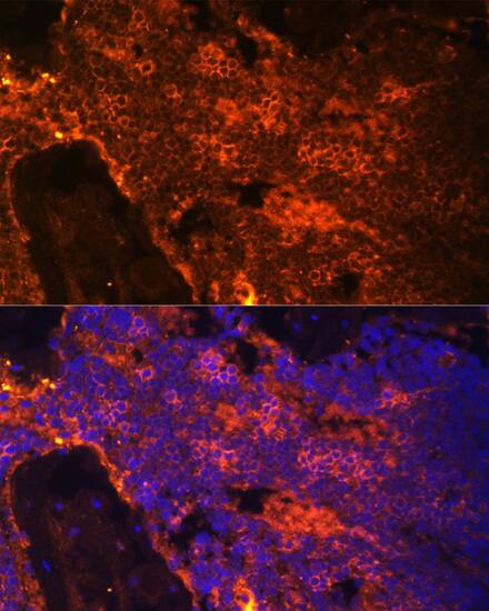 Immunocytochemistry/ Immunofluorescence: Spectrin alpha 1 Antibody [NBP3-36712] - Immunofluorescence analysis of paraffin-embedded rat bone marrow using Spectrin alpha 1 Rabbit pAb at dilution of 1:100. Secondary antibody: Cy3-conjugated Goat anti-Rabbit IgG (H+L) at 1:500 dilution. Blue: DAPI for nuclear staining.