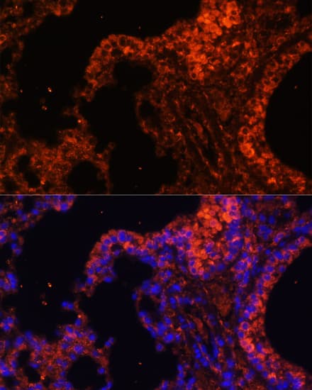 Immunocytochemistry/ Immunofluorescence: Spectrin alpha 1 Antibody [NBP3-36712] - Immunofluorescence analysis of paraffin-embedded mouse lung using Spectrin alpha 1 Rabbit pAb at dilution of 1:100. Secondary antibody: Cy3-conjugated Goat anti-Rabbit IgG (H+L) at 1:500 dilution. Blue: DAPI for nuclear staining.