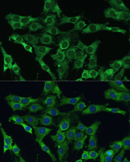 Immunocytochemistry/ Immunofluorescence PLSCR3 Antibody