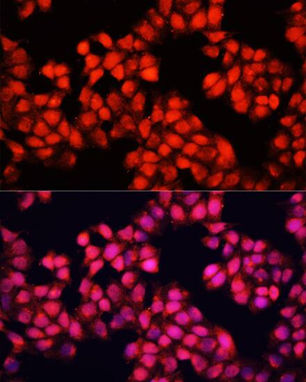 Immunocytochemistry/ Immunofluorescence: ALAD Antibody [NBP3-36714] - Immunofluorescence analysis of HeLa cells using ALAD Rabbit pAb at dilution of 1:100. Secondary antibody: Cy3-conjugated Goat anti-Rabbit IgG (H+L) at 1:500 dilution. Blue: DAPI for nuclear staining.