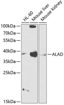 Western Blot: ALAD Antibody [NBP3-36714] - Western blot analysis of various lysates using ALAD Rabbit pAb at 1:1000 dilution.Secondary antibody: HRP-conjugated Goat anti-Rabbit IgG (H+L) at 1:10000 dilution.Lysates/proteins: 25ug per lane.Blocking buffer: 3% nonfat dry milk in TBST.Detection: ECL Basic Kit.Exposure time: 90s.