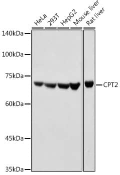 Western Blot: CPT2 Antibody [NBP3-36715] - Western blot analysis of various lysates using CPT2 Rabbit pAb at 1:1000 dilution.Secondary antibody: HRP-conjugated Goat anti-Rabbit IgG (H+L) at 1:10000 dilution.Lysates/proteins: 25ug per lane.Blocking buffer: 3% nonfat dry milk in TBST.Detection: ECL Basic Kit.Exposure time: 1s.