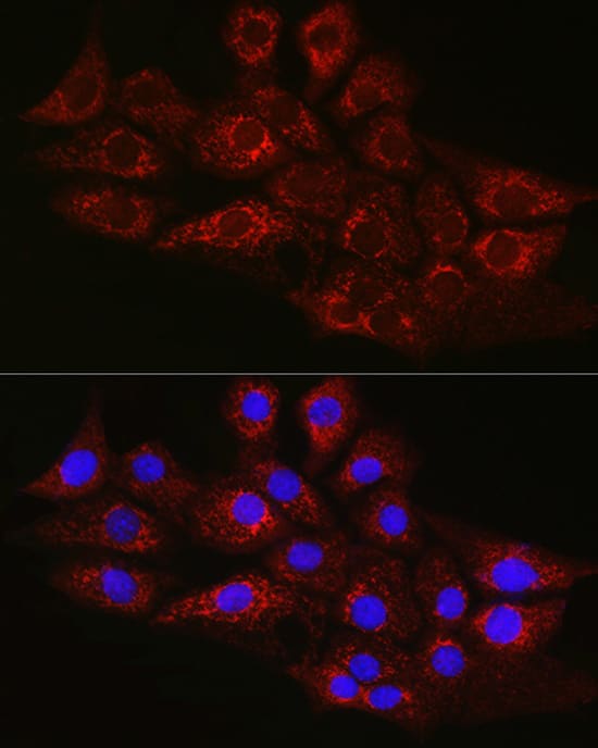 Immunocytochemistry/ Immunofluorescence: CPT2 Antibody [NBP3-36715] - Immunofluorescence analysis of NIH/3T3 cells using CPT2 Rabbit pAb at dilution of 1:100 (40x lens). Secondary antibody: Cy3-conjugated Goat anti-Rabbit IgG (H+L) at 1:500 dilution. Blue: DAPI for nuclear staining.