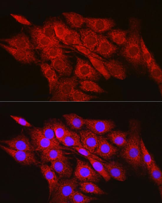 Immunocytochemistry/ Immunofluorescence: CPT2 Antibody [NBP3-36715] - Immunofluorescence analysis of PC-12 cells using CPT2 Rabbit pAb at dilution of 1:100 (40x lens). Secondary antibody: Cy3-conjugated Goat anti-Rabbit IgG (H+L) at 1:500 dilution. Blue: DAPI for nuclear staining.