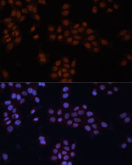 Immunocytochemistry/ Immunofluorescence: TFII-I Antibody [NBP3-36717] - Immunofluorescence analysis of HeLa cells using TFII-I Rabbit pAb at dilution of 1:100. Secondary antibody: Cy3-conjugated Goat anti-Rabbit IgG (H+L) at 1:500 dilution. Blue: DAPI for nuclear staining.