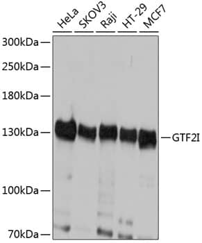 Western Blot: TFII-I Antibody [NBP3-36717] - Western blot analysis of various lysates using TFII-I Rabbit pAb at 1:1000 dilution.Secondary antibody: HRP-conjugated Goat anti-Rabbit IgG (H+L) at 1:10000 dilution.Lysates/proteins: 25ug per lane.Blocking buffer: 3% nonfat dry milk in TBST.Detection: ECL Basic Kit.Exposure time: 1s.