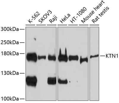 Western Blot: kinectin Antibody [NBP3-36718] - Western blot analysis of various lysates using kinectin Rabbit pAb at 1:1000 dilution.Secondary antibody: HRP-conjugated Goat anti-Rabbit IgG (H+L) at 1:10000 dilution.Lysates/proteins: 25ug per lane.Blocking buffer: 3% nonfat dry milk in TBST.Detection: ECL Basic Kit.Exposure time: 90s.