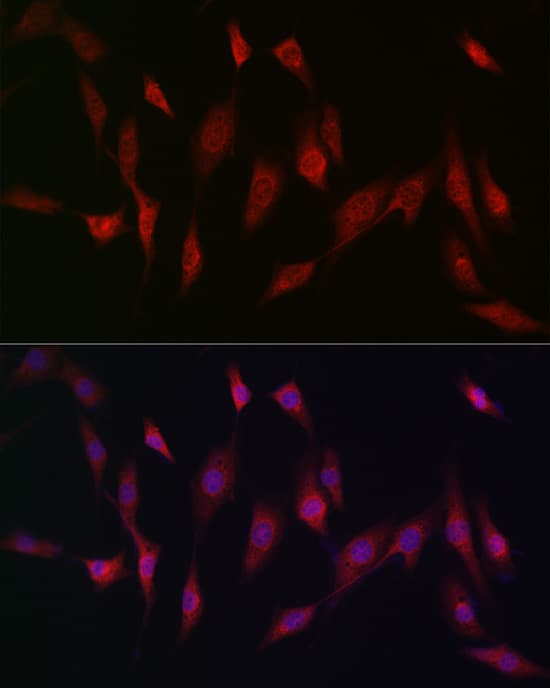 Immunocytochemistry/ Immunofluorescence Methionine Sulfoxide Reductase A Antibody - BSA Free