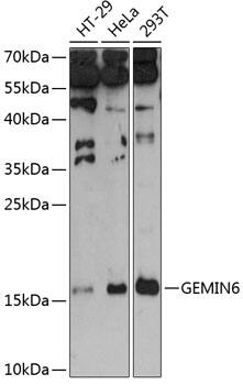 Western Blot: GEMIN6 Antibody [NBP3-36721] - Western blot analysis of various lysates using GEMIN6 Rabbit pAb at 1:3000 dilution.Secondary antibody: HRP-conjugated Goat anti-Rabbit IgG (H+L) at 1:10000 dilution.Lysates/proteins: 25ug per lane.Blocking buffer: 3% nonfat dry milk in TBST.Detection: ECL Basic Kit.Exposure time: 90s.