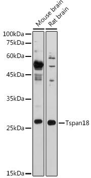 Western Blot: TSPAN18 Antibody [NBP3-37885] - Western blot analysis of various lysates using TSPAN18 Rabbit pAb at 1:1000 dilution.Secondary antibody: HRP-conjugated Goat anti-Rabbit IgG (H+L) at 1:10000 dilution.Lysates/proteins: 25ug per lane.Blocking buffer: 3% nonfat dry milk in TBST.Detection: ECL Basic Kit.Exposure time: 10s.