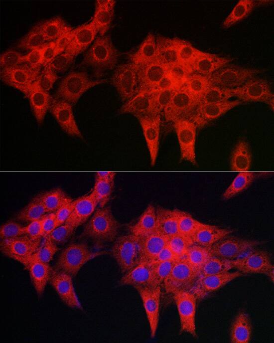 Immunocytochemistry/ Immunofluorescence: PDLIM4 Antibody [NBP3-37889] - Immunofluorescence analysis of PC-12 cells using PDLIM4 Rabbit pAb at dilution of 1:50 (40x lens). Secondary antibody: Cy3-conjugated Goat anti-Rabbit IgG (H+L) at 1:500 dilution. Blue: DAPI for nuclear staining.